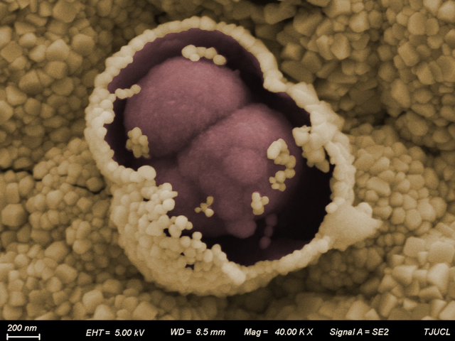 顯微鏡下的花生.png 顯微鏡下的花生.png