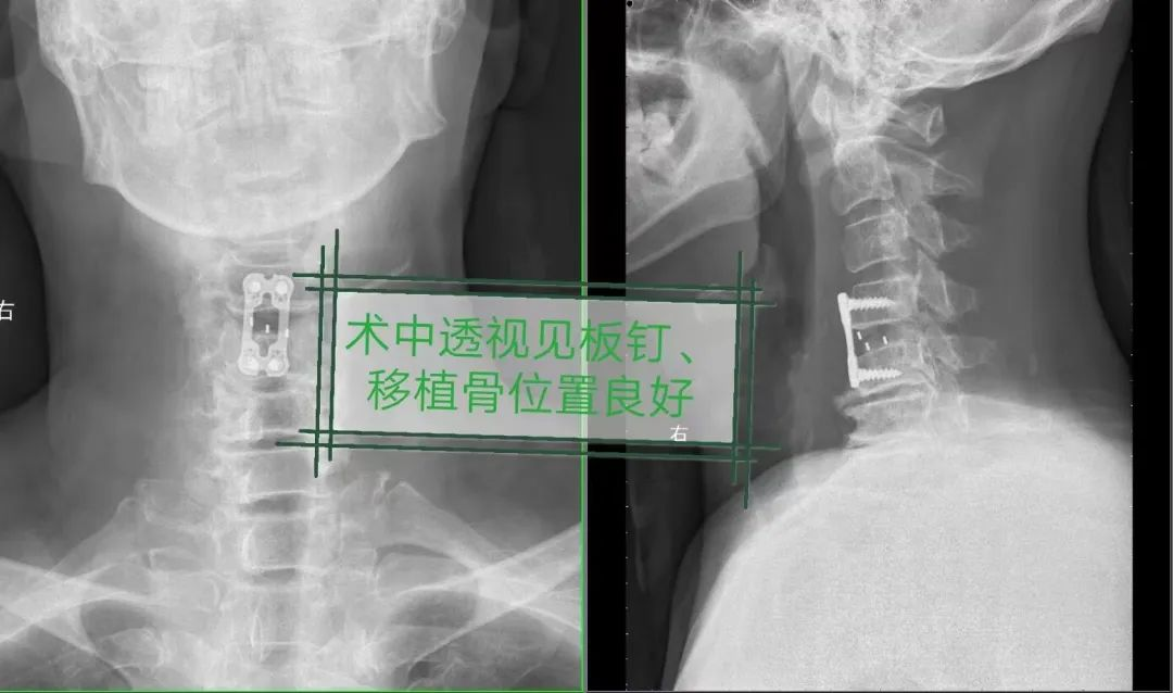 1666669572786926.png 1666669572786926.png